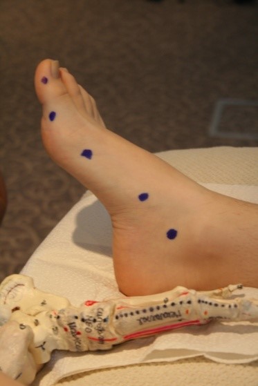 metoda sarafijn slika1