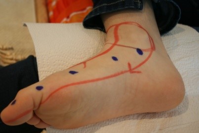 metoda sarafijn slika1